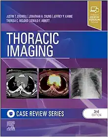 Thoracic Imaging: Case Review, 3rd Edition (Original PDF From Publisher)