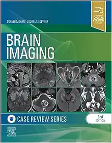 Brain Imaging: Case Review Series, 3rd Edition (Original PDF From Publisher)