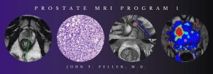 2021 Prostate MRI (Program 1) – John F. Feller, M.D (Videos)