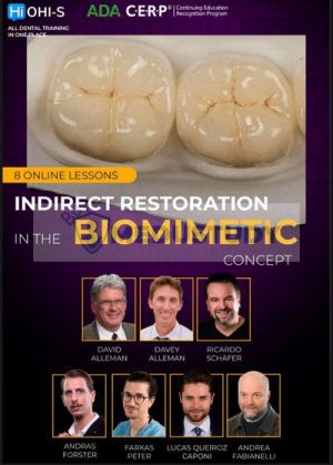 OHI-S Indirect Restoration in the Biomimetic Concept