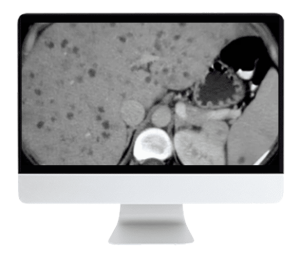 ARRS State of the Art Liver Imaging in Cirrhosis 2021 (CME VIDEOS)