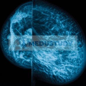 UCSF Breast Imaging 2024
