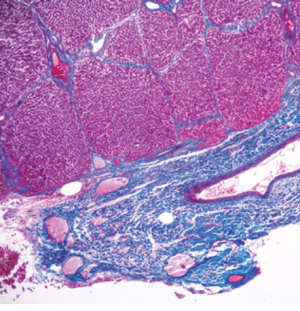 Current Topics in Gastrointestinal and Liver Pathology 2023