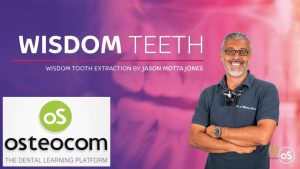 Osteocom Wisdom Tooth Extraction  Jason Motta Jones