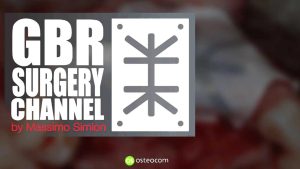 Osteocom GBR Surgery Channel (International) – Massimo Simion