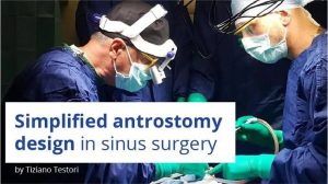 Osteocom – Simplified Antrostomy Design in Sinus Surgery – Tiziano Testori