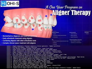 OHI-S A One Year Program on Aligner Therapy